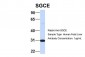 SGCE antibody - N-terminal region